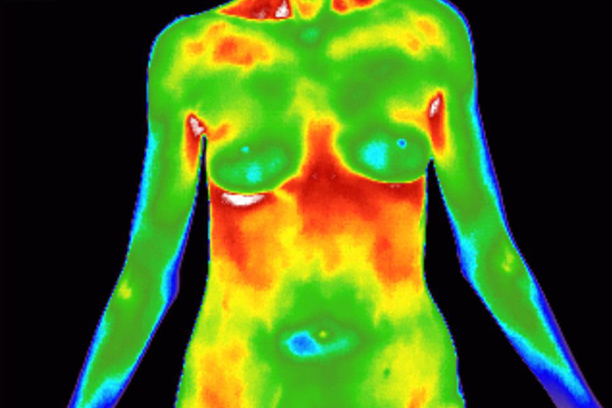 Early Detection Through Breast Thermography